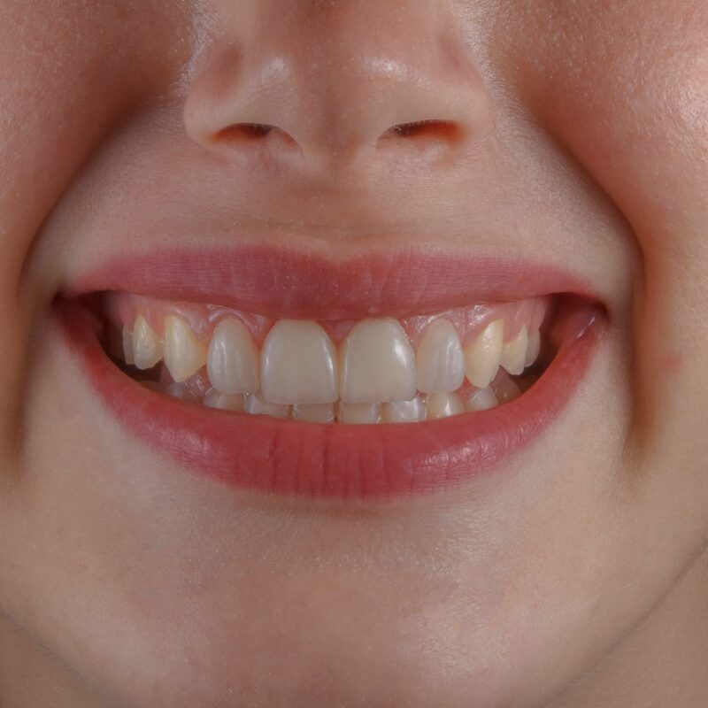 A woman with a big grin showing her teeth